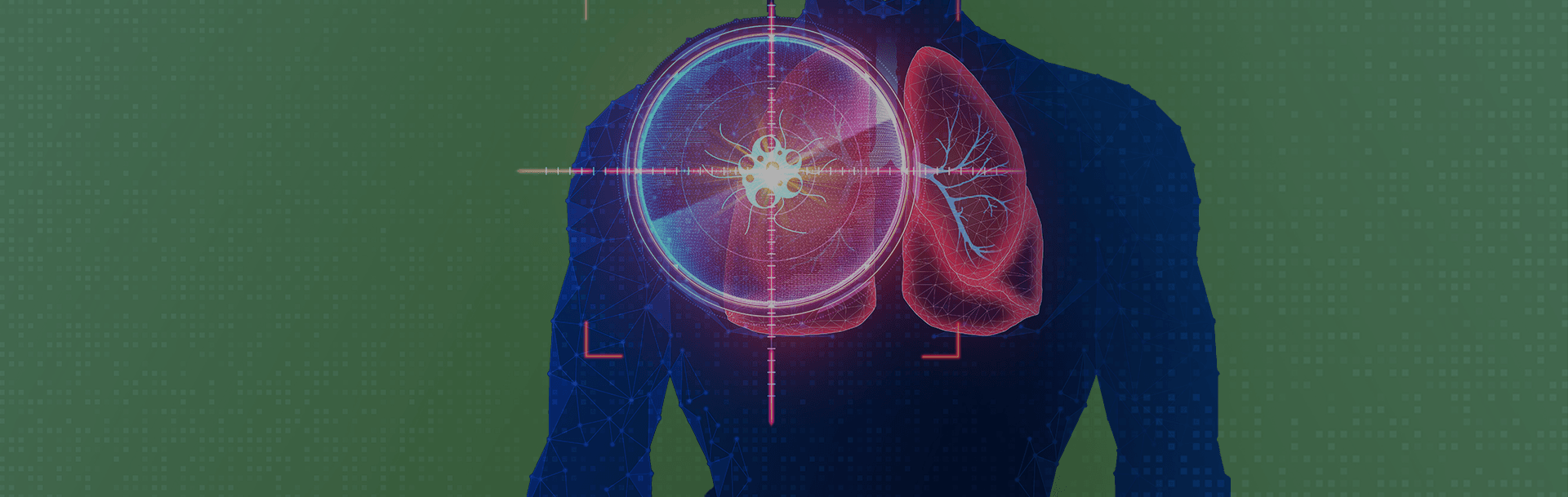 ONCOLOGY